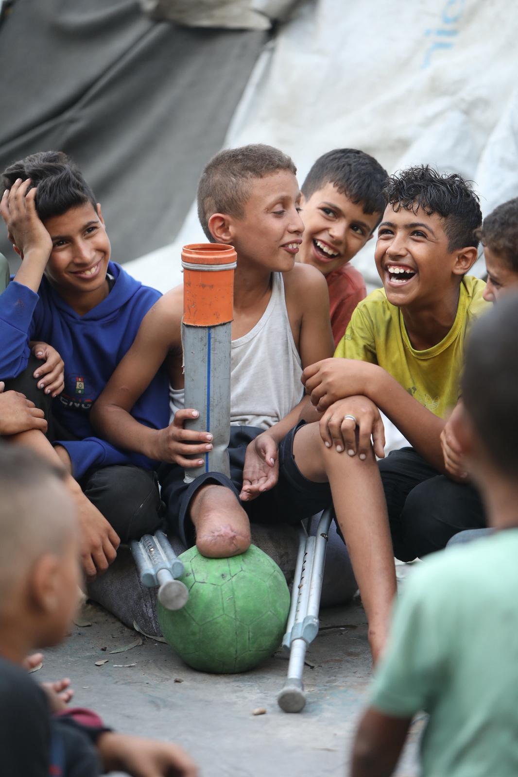 Rateb sonríe junto a sus amigos en Gaza mientras lleva una prótesis en su pierna amputada.